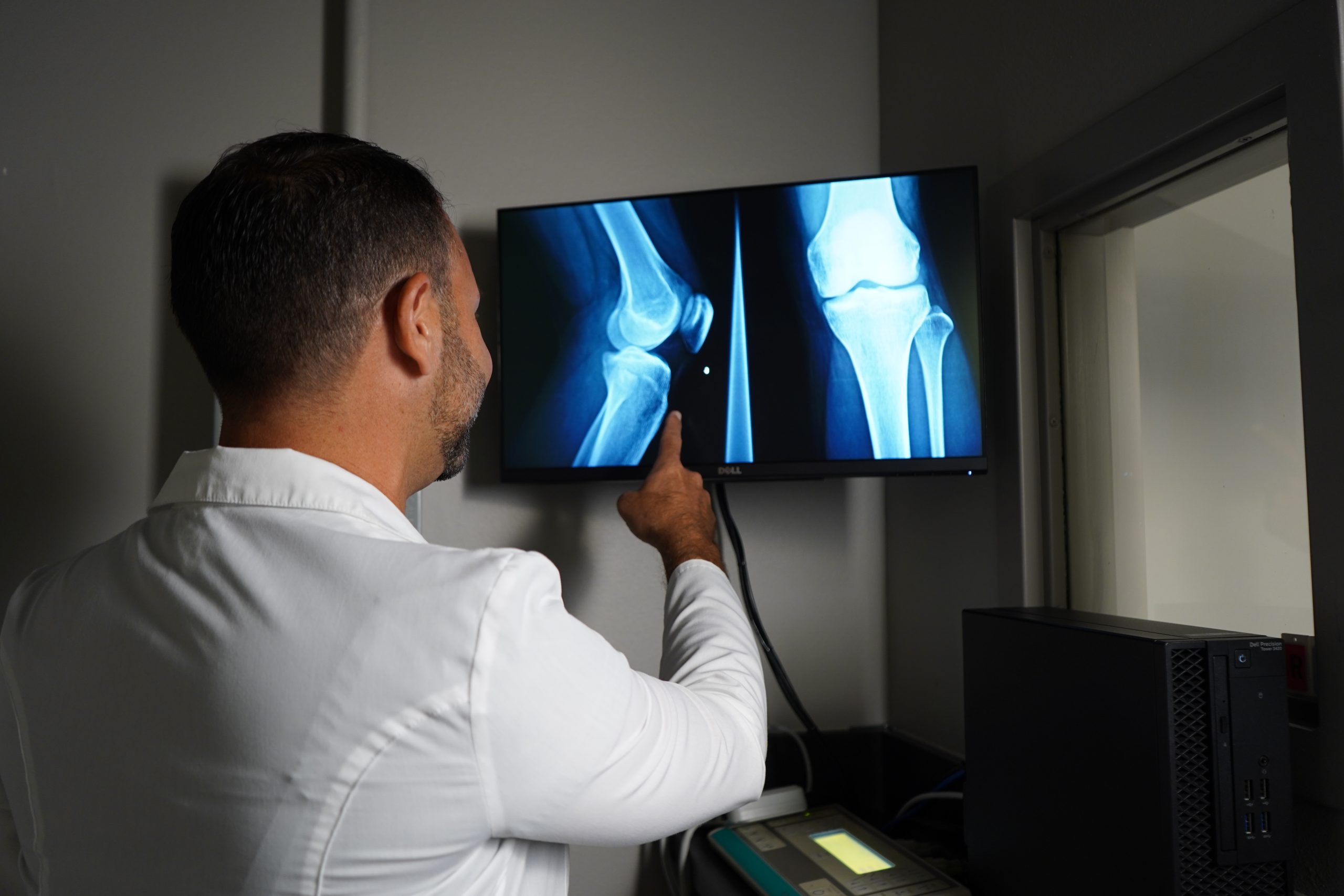 a doctor pointing at an x-ray of a knee